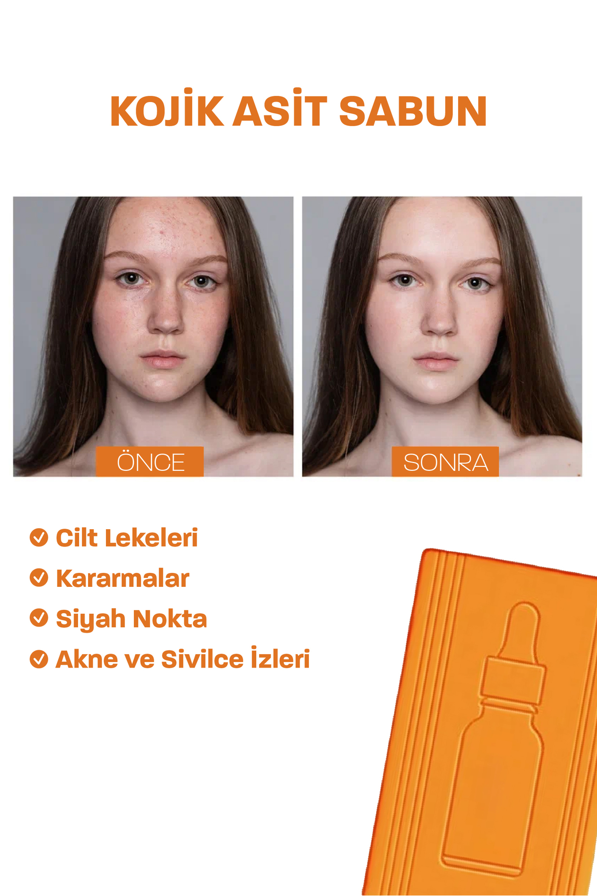 Quality Life Doğal Kojik Asit Sabunu 5 Aktif Leke Kararma Karşıtı Beyazlatıcı Akne Yağ Sebum Dengeleme - Görsel 3