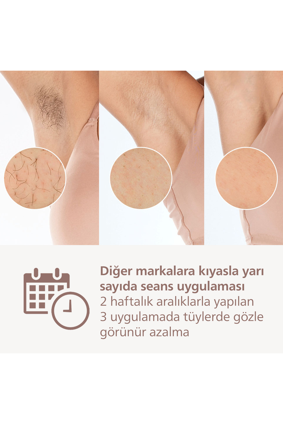 Philips Lumea 9900 Serisi BRI950/02 IPL Tüy Alma, SkinAI Uygulama, Vücut ve Yüz için 2 Başlık, Çanta - Görsel 3