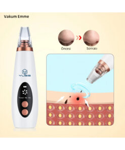 Alternative view of YUES Vakumlu Siyah Nokta Temizleme Cihazı – 3 Mod, Şarjlı, 6 Başlık, Akne/Komedeon Karşıtı Yüz Bakım