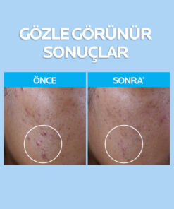 Alternative view of La Roche Posay Yağlı Ciltler İçin Cilt Bakım Seti : Effaclar Yüz Temizleme Jeli 400ml & Sıklaştırıcı Tonik 200ml