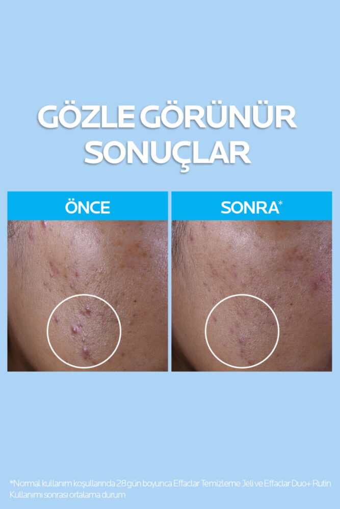 La Roche Posay Yağlı Ciltler İçin Cilt Bakım Seti : Effaclar Yüz Temizleme Jeli 400ml & Sıklaştırıcı Tonik 200ml - Görsel 2