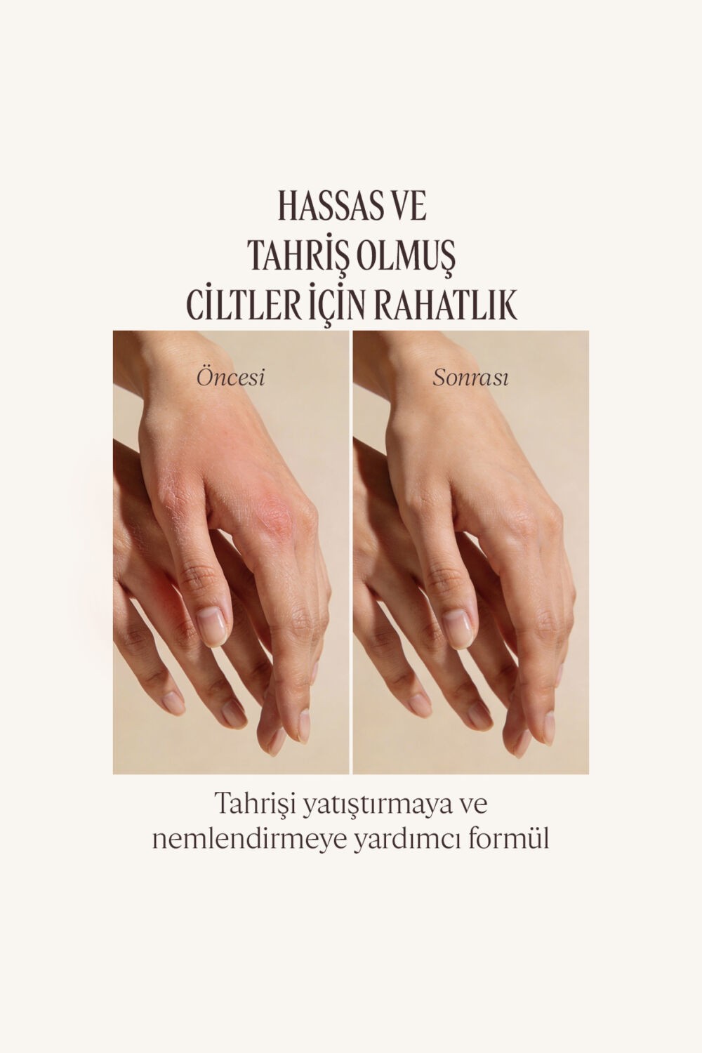 L'Occitane Shea El Kremi, Shea Yağı İçeren Besleyici ve Nemlendirici, 150 ml - Görsel 2