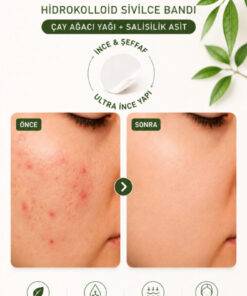 Alternative view of Secel Çay Ağacı & Salisilik Asitli Hidrokolloid 36’lı Akne ve Sivilce Bandı, Şeffaf Acne Patch
