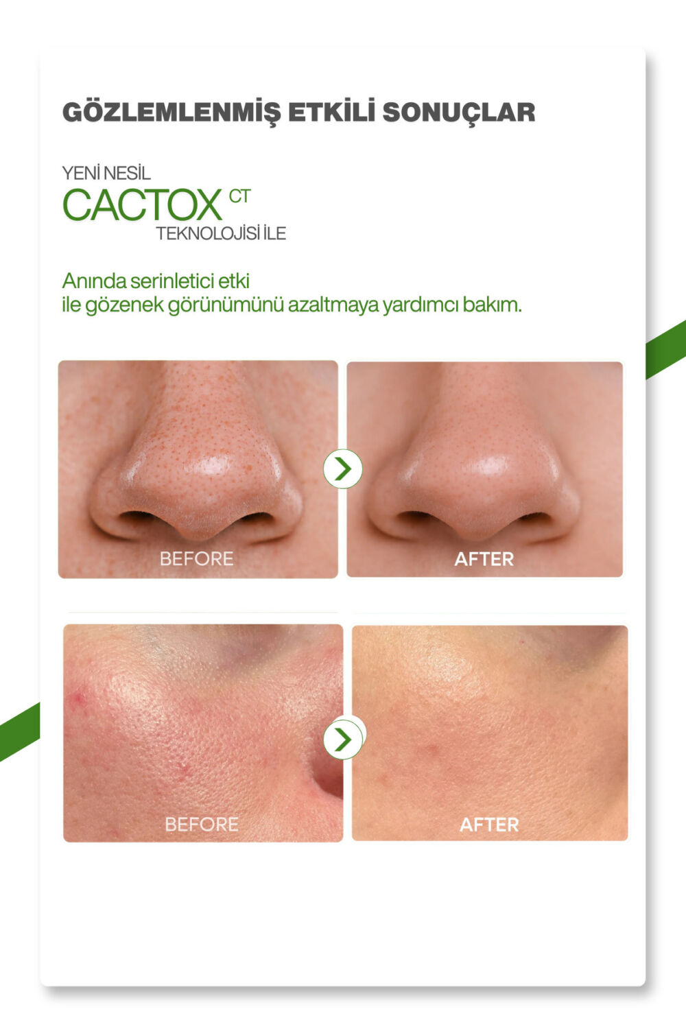 Dr.Melaxin Kaktüs Özlü | Gözenek Sıkılaştırıcı | Serinletici | Cactox Multi Balm 25gr - Görsel 2