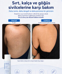 YoCells Akne ve Sivilce Görünümüne Karşı Duş Jeli – Sırt, Göğüs, Kalça | Salisilik Asit + Glikolik Asit, pH Dengeli, Unisex 250 ml - Görsel 3