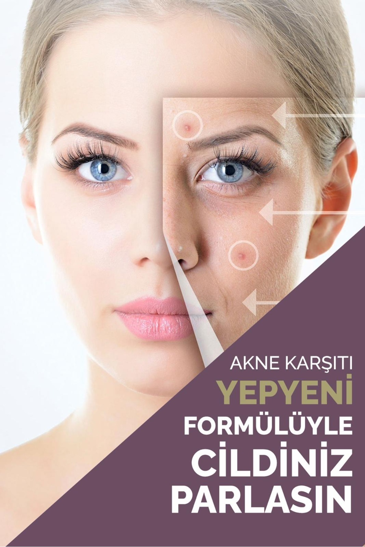 Olivia Wilson Vitamin İçeren Sîvîlce Önleyeci Siyah Nokta Sîvîlce - Âkne Karşıtı Krem 100 ml - Görsel 2