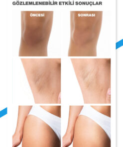 Alternative view of Dr.Melaxin Leke Karşıtı | Aydınlatıcı | Traneksamik Asit içeren | TX Vücut Peeling Spreyi 200ml