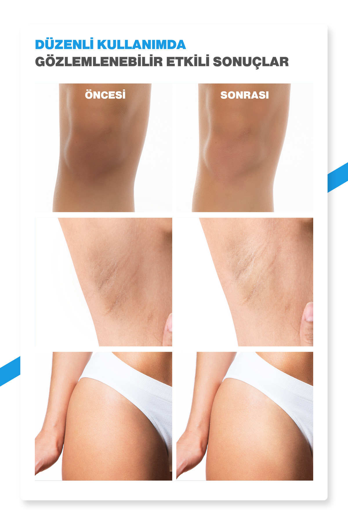 Dr.Melaxin Leke Karşıtı | Aydınlatıcı | Traneksamik Asit içeren | TX Vücut Peeling Spreyi 200ml - Görsel 2